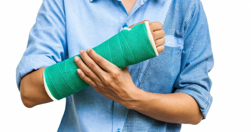 Fractures - Types, causes, symptoms, and treatment
